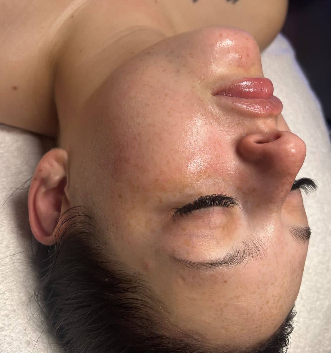 Skincare result
