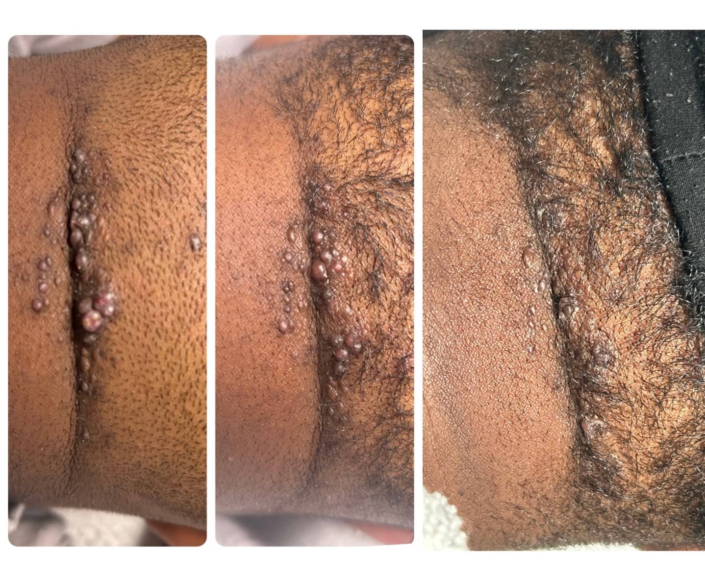 Skincare result